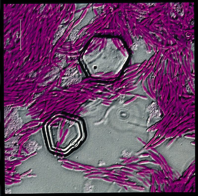 Cystein Microscop